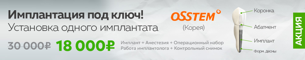 osstem имплант под ключ цена osstem имплант под ключ цена